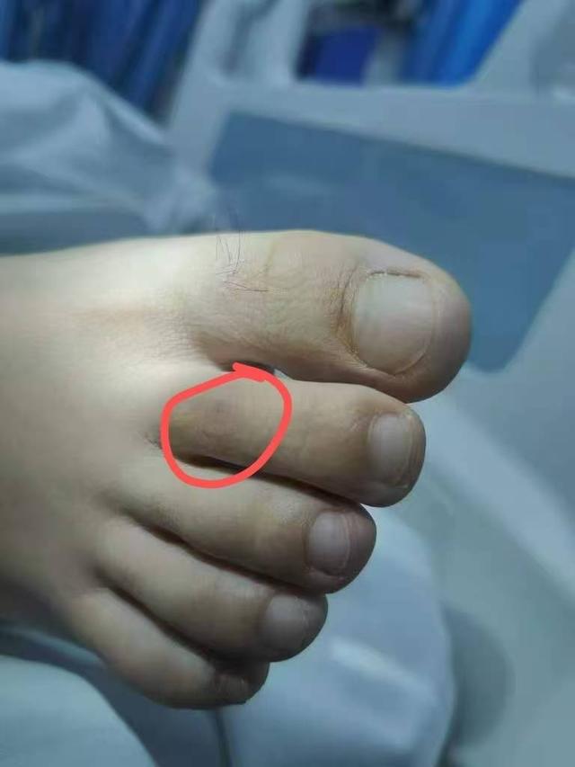 类博主两天涨粉200万电话被打爆交给朋友接听pg电子平台三亚女游客被蛇咬身亡事件带火蛇(图5)